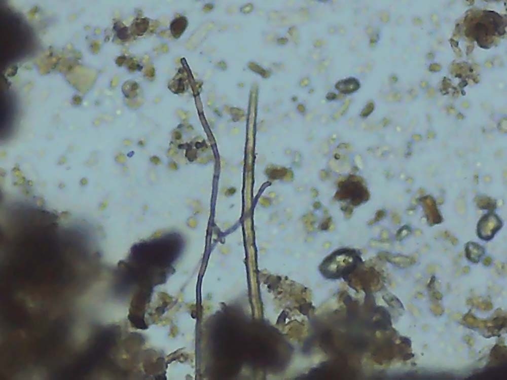 Beneficial fungi