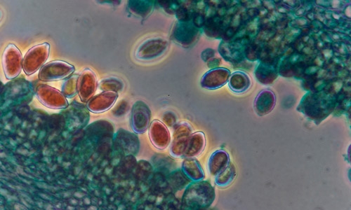 Spores on slide