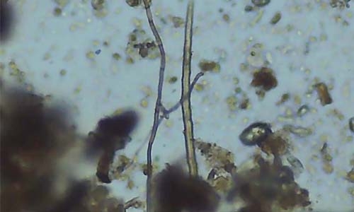 fungi under microscope thumbnail